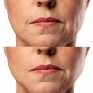 МІКРОСТРУМОВИЙ RF ЛІФТИНГ-МАСАЖЕР ДЛЯ ОБЛИЧЧЯ MEDICA+ SKIN LIFTING 7.0 WHITE ЯПОНІЯ (EMS+LED)